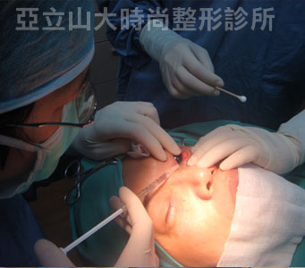 眼袋手術