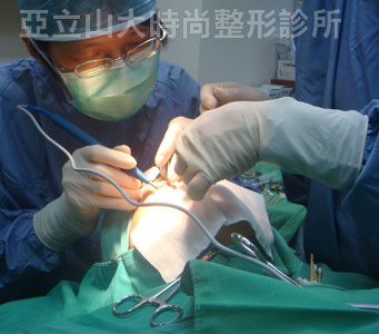 眼袋手術