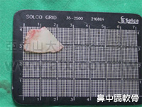 cartilage and Goretex