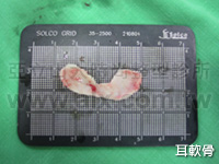 cartilage and Goretex