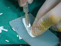 cartilage and Goretex